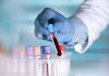 Gloved hand holding a blood sample test tube