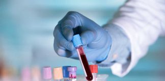 Gloved hand holding a blood sample test tube