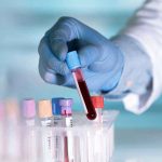 20-Year Addiction Becomes White House Megaphone Gloved hand holding a blood sample test tube.